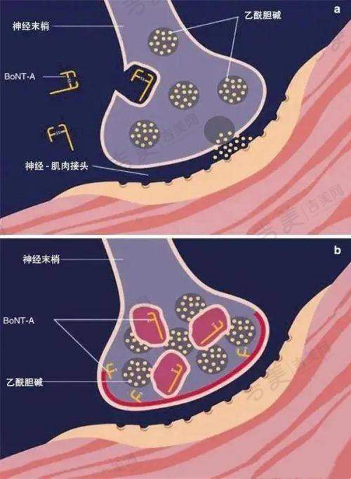 宁夏华美整形美容膨体隆鼻修复52000元起与其他医院对比分析