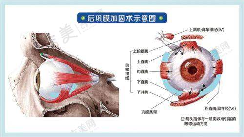 八、上海和平眼科医院近视手术费用包含项目及后续保护