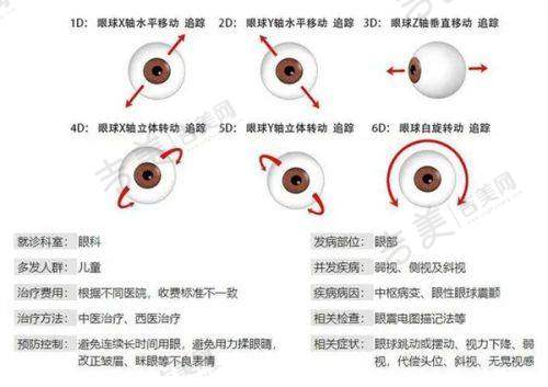 五、重庆何氏眼科和爱尔眼科哪家更好详情之极高度近视眼矫正技术