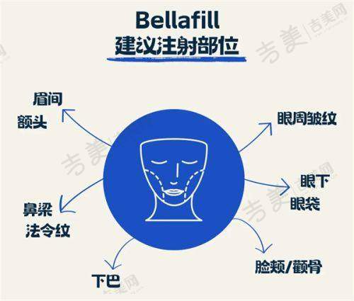 隆胸假体破裂取出直接换假体的并发症发生率情况