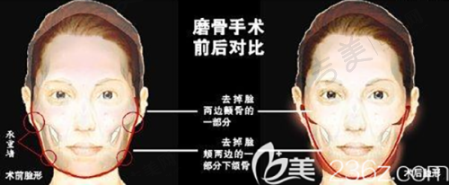 苏州吴中维多利亚美容医院江华医生的个人资料简介