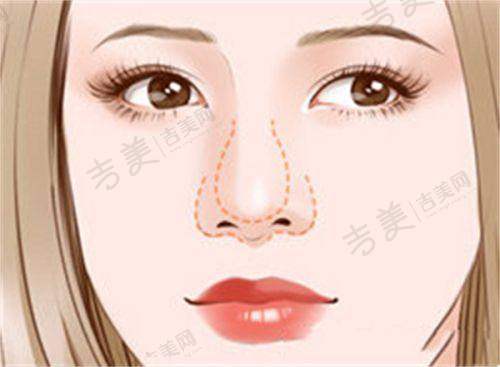 顾客对邓莎莎医生的真实好评见证实力