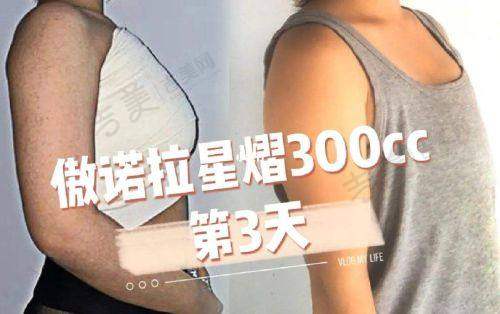 刘健医生擅长的面部整形手术等项目