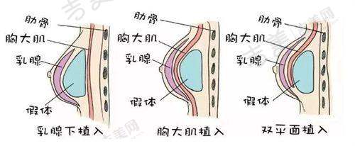 于海生医生的技术优势:注重细节与个性化设计