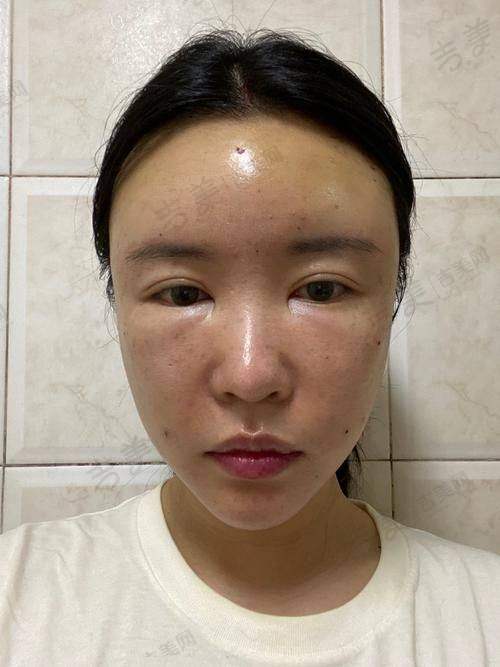 王贵贤医生的技术优势亮点