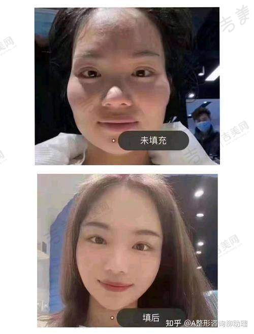 王贵贤医生的顾客好评实例