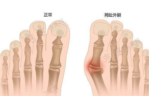 马梅生面部吸脂技术及价格情况——真实实例展示