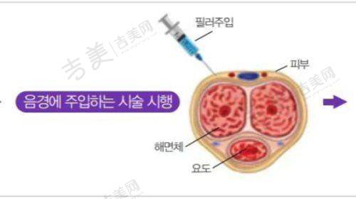 九、遵义排名前七的正规整形医院是否有值得 pick 的:真人实例说话