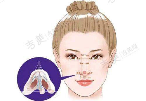 二、深圳张辉隆鼻优势特色情况：特色优势大揭秘