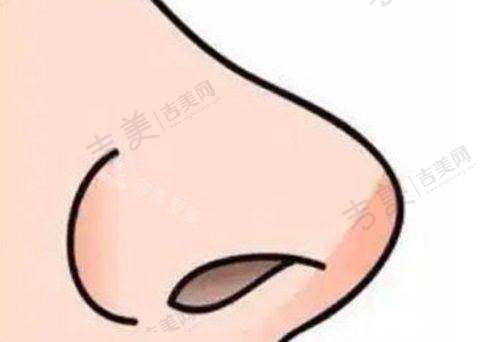 五、深圳张辉做鼻子价格合理性：性价比高不高？