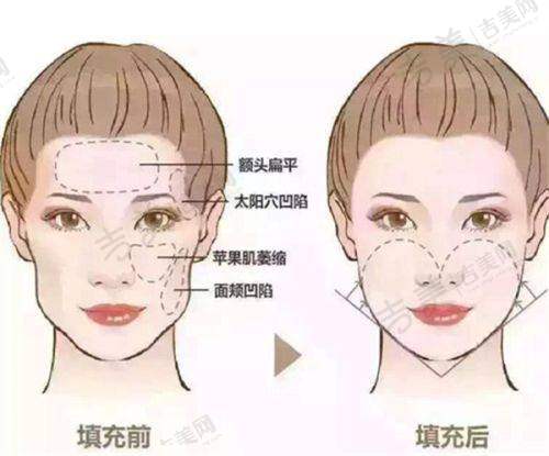 遵义正规整形医院排名榜前七情况分享：实力揭秘、真人案例见证，有你想pick的那家吗？