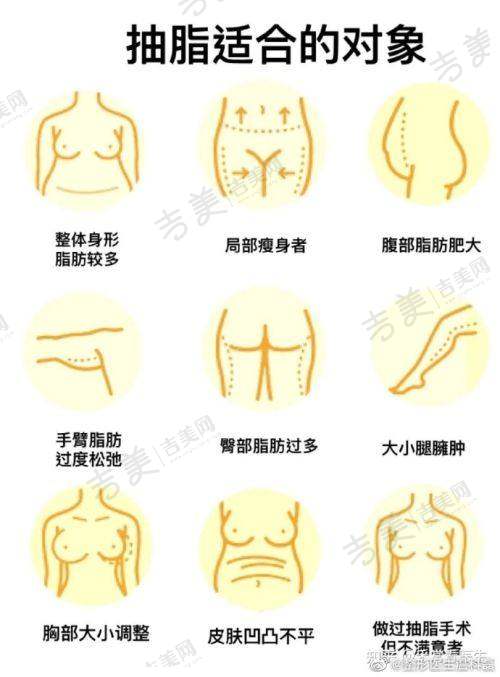 三、胡凯做鼻子实例图片大揭秘