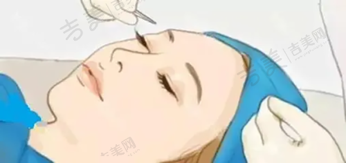 三、遵义排名前七的正规整形医院实力介绍:汇川广慈医院有何亮点?