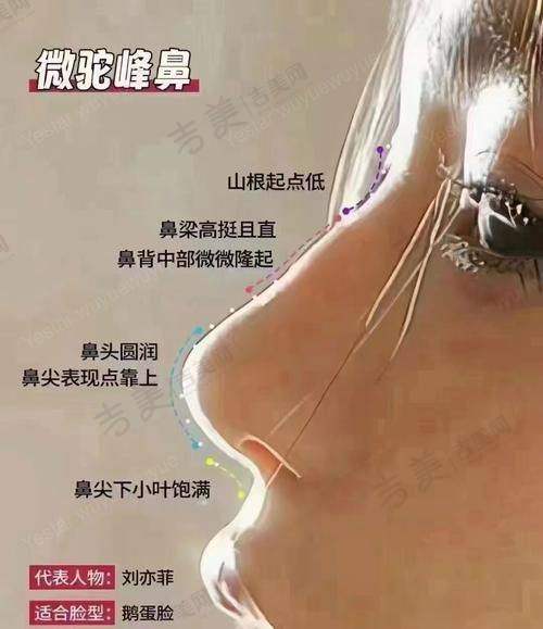 师俊莉做鼻子怎么样？师俊莉鼻子做得很一般还好贵是真的吗？技术水平、价格及效果评价大揭秘