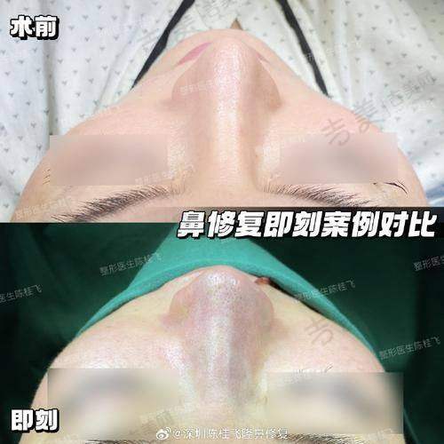 八、师俊莉做鼻子技术水平如何：技术创新与发展
