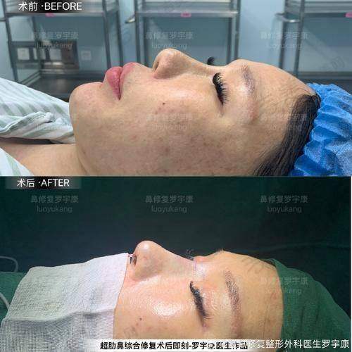 六、师俊莉做鼻子技术水平如何：审美优势在哪里？