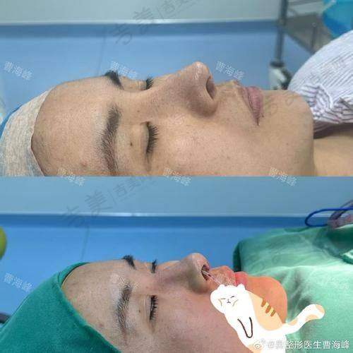 七、师俊莉做鼻子技术水平如何：技术实力有多强？