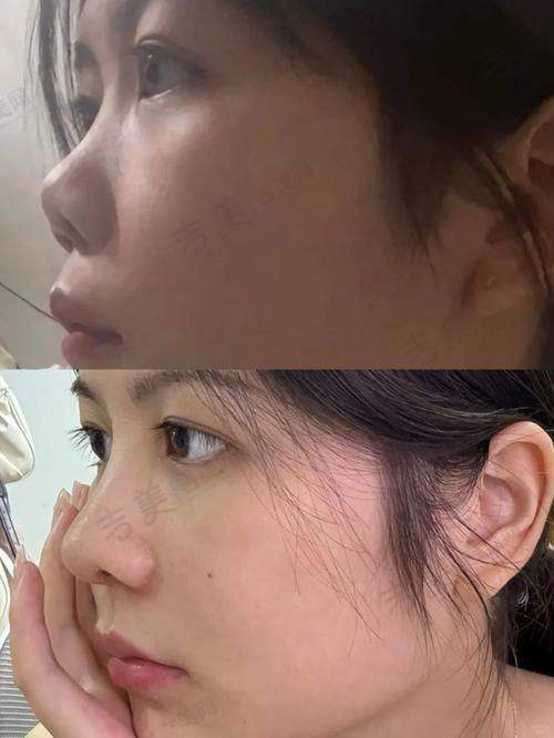 八、深圳张辉做鼻子未来发展展望：医生的前景如何？