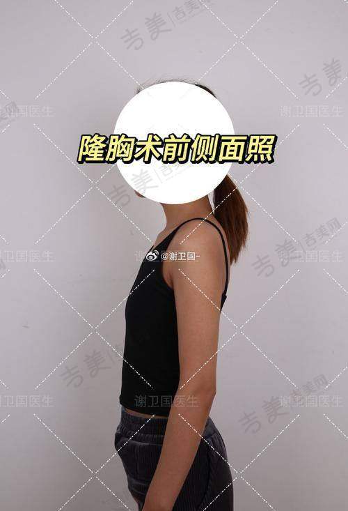 长沙做乳房悬吊术哪家医院好？内行人推荐口碑好、效果优且收费合理的医院