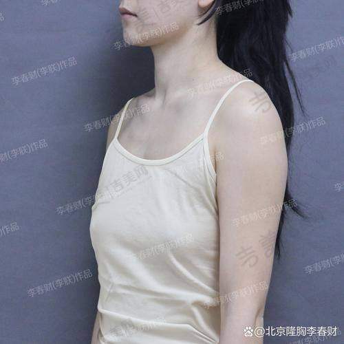 长沙做乳房悬吊术内行人选择的医院推荐：湖南中 医 药大学第一附属医院烧伤整形科
