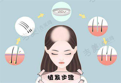西安高一生史文君医生的擅长项目