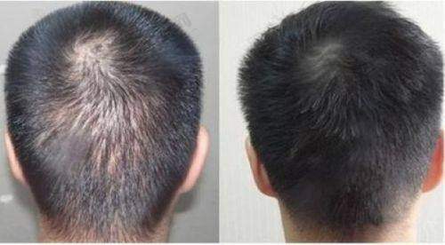 济南碧莲盛植发诊所医生简介