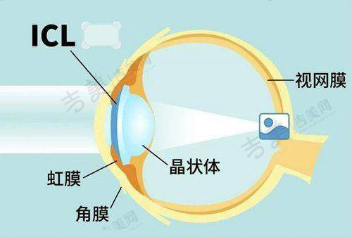 七、丹东郭氏眼科医院郭凌云医生预约挂号攻略