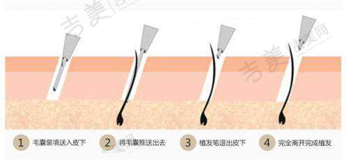 西安高一生史文君医生的执医荣誉