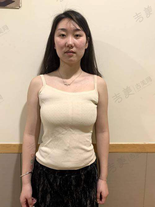 金磊医生擅长的整形美容项目
