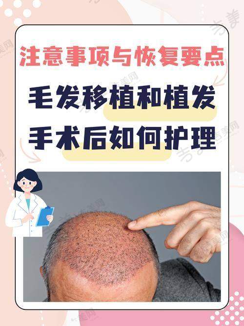 李世涛医生擅长的毛发移植项目