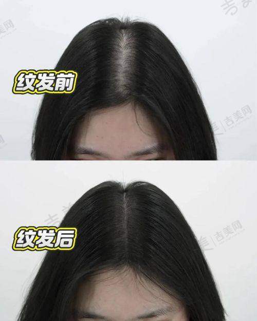 南京碧莲盛植发医院基本信息