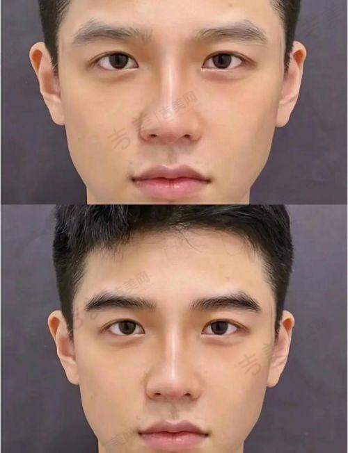 南京碧莲盛植发医院怎么样,口碑评价如何?