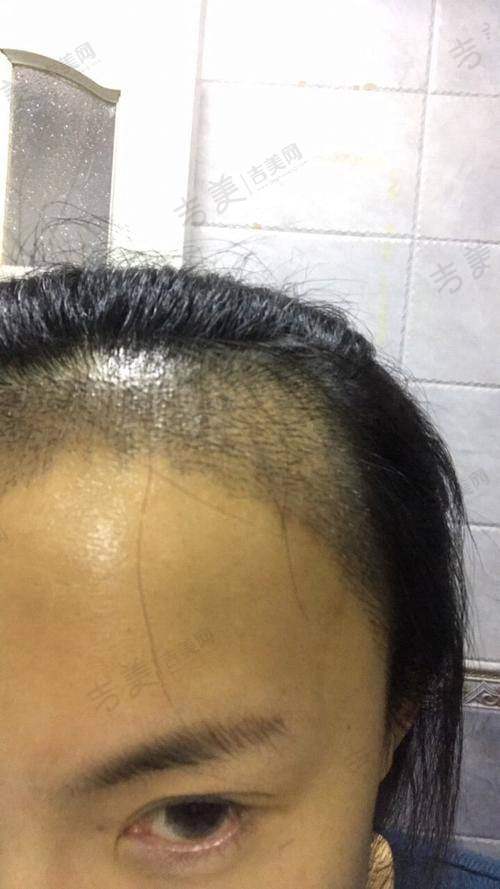 成都碧莲盛植发医院地址及乘车路线