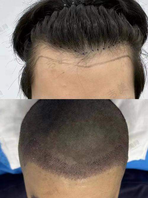 西安高一生史文君医生的口碑评价及反馈内容