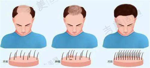 深圳南山香蜜丽格医疗美容诊所地址及乘车路线