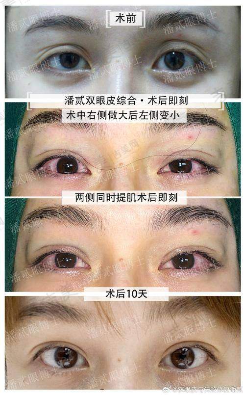 重庆郑荃丽格青春医疗美容门诊部口碑好不好?附真实患者口碑评价