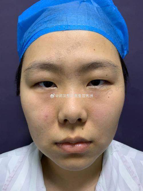 深圳丽格优德医疗美容诊所价格表