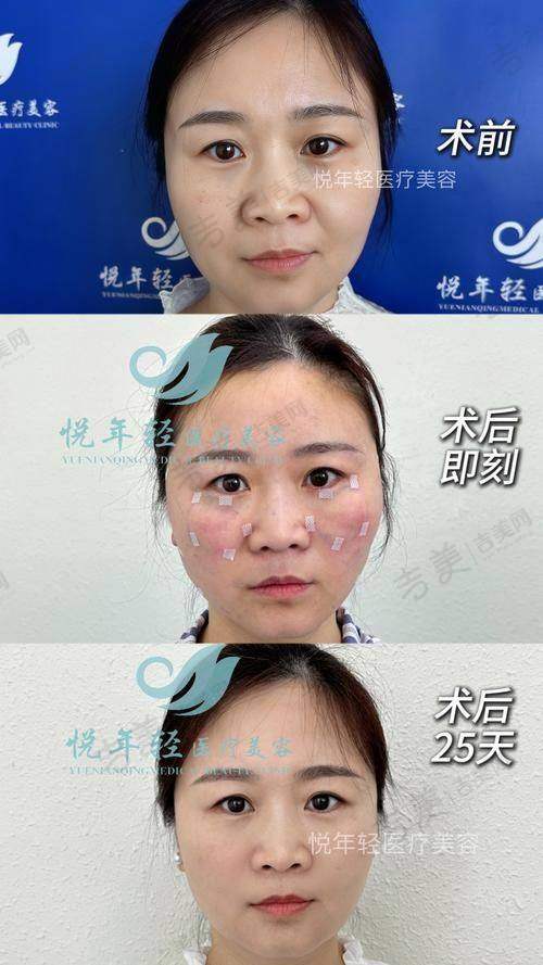 李文峰医生的技术优势体现