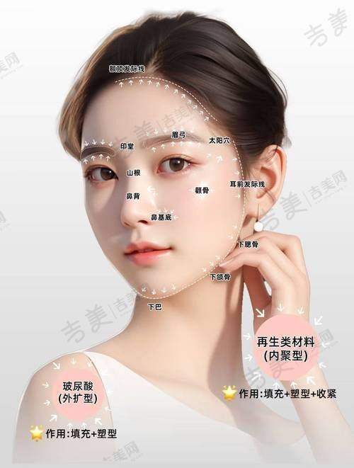 阮庆玲医生的技术优势亮点