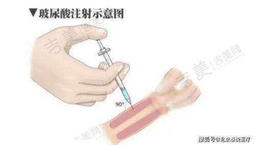 于赫楠医生擅长的医美项目