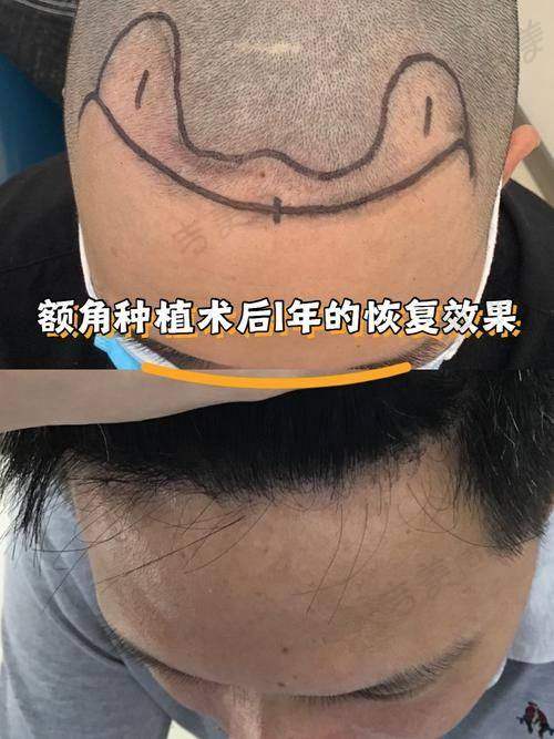 北京冰新丽格医疗美容门诊部口碑好不好?附真实患者口碑评价