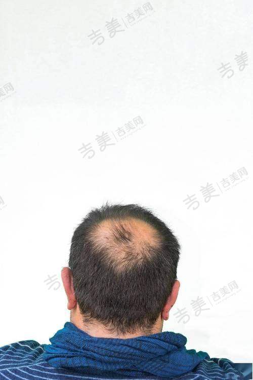 北京冰新丽格医疗美容门诊部项目特色
