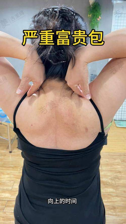 广州联合丽格医疗美容门诊部口碑好不好?附真实患者口碑评价