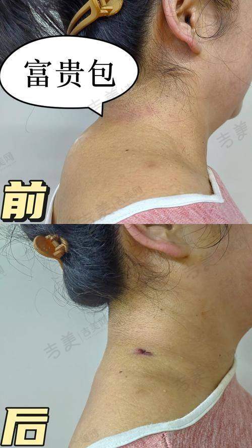 合肥台美丽格医疗美容门诊部价格表