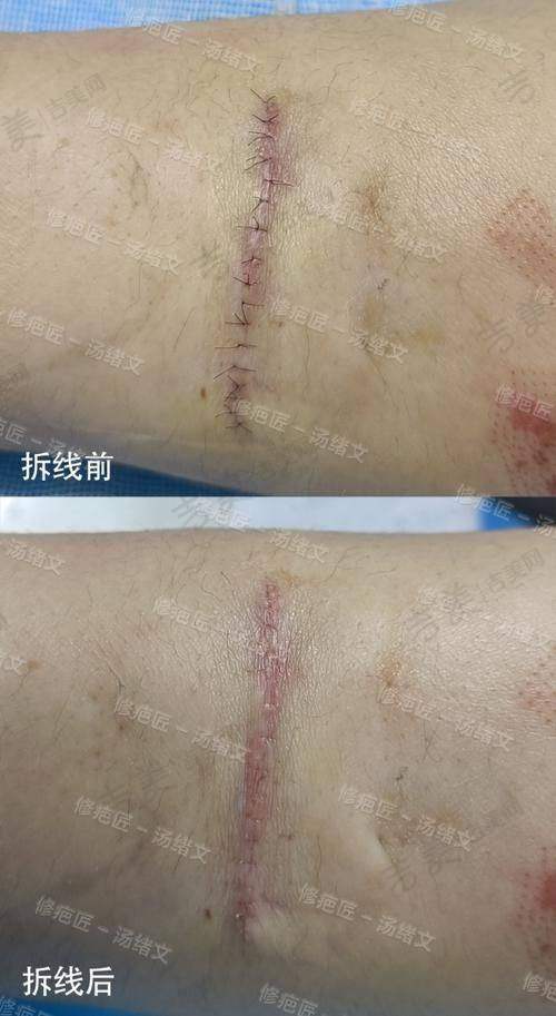 深圳星荟丽格医疗美容诊所口碑好不好?附真实患者口碑评价