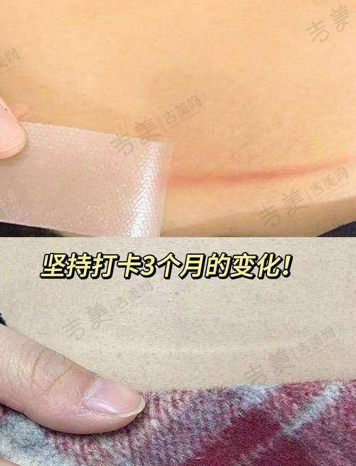 济南悦菩丽格医疗美容门诊部口碑好不好?附真实患者口碑评价