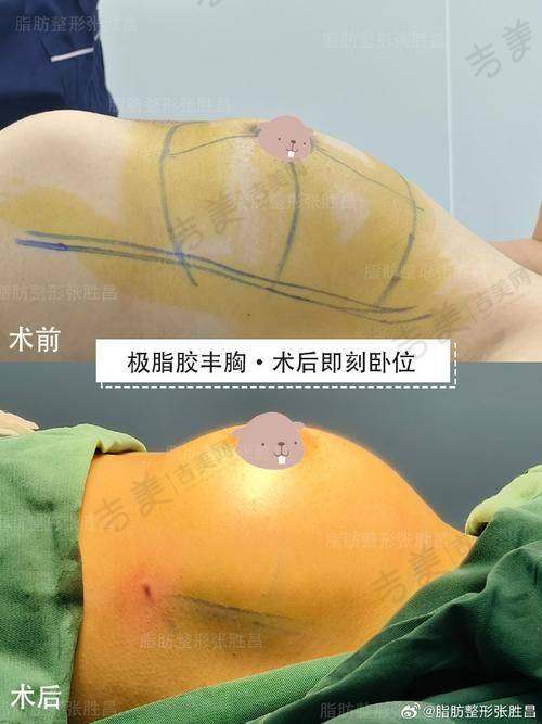 李文峰医生的执医荣誉相关