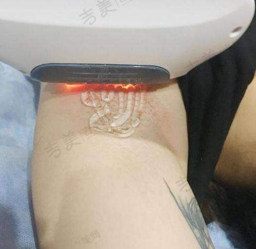 赣州明珠丽格医疗美容医院口碑好不好?附真实患者口碑评价
