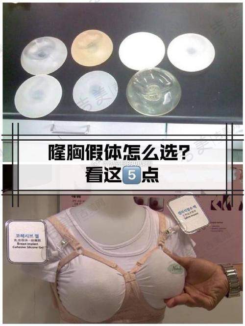 阮庆玲医生的口碑评价与反馈