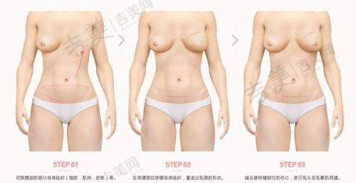重庆徐铎丽格整形美容医院口碑好不好？附真实患者口碑评价